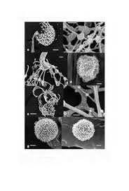 Attēlu rezultāti vaicājumam “Cribraria piriformis stalked”