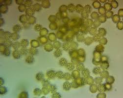 Attēlu rezultāti vaicājumam “Hemitrichia clavata spores”