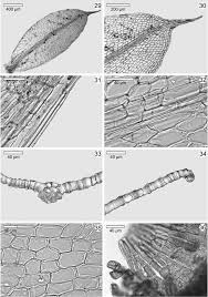 Attēlu rezultāti vaicājumam “Tortula truncata sporophyte”