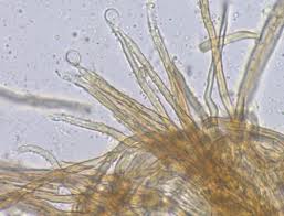 Attēlu rezultāti vaicājumam “Merismodes anomala”