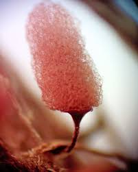 Attēlu rezultāti vaicājumam “Lycogala fuscoolearium macro”