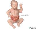 Saint Thomas Health - Health Information - Infant intestines