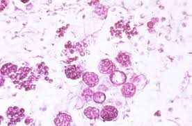 Attēlu rezultāti vaicājumam “Diderma subviridifuscum spores”