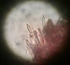 Attēlu rezultāti vaicājumam “Ionomidotis irregularis”