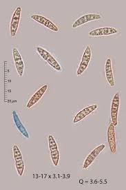 Attēlu rezultāti vaicājumam “Sporophagomyces chrysostomus”