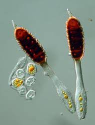 Attēlu rezultāti vaicājumam “Phragmidium sp.”