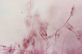 Attēlu rezultāti vaicājumam “Ascomycota”