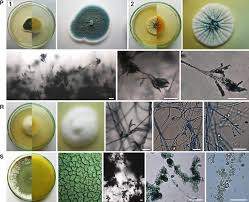 Attēlu rezultāti vaicājumam “Trichia ambigua spores”