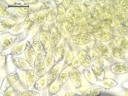 Attēlu rezultāti vaicājumam “Cephaloziella elachista”