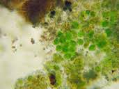 Attēlu rezultāti vaicājumam “Chaenotheca chrysocephala”