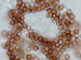 Attēlu rezultāti vaicājumam “Physarum globuliferum spores”