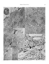Attēlu rezultāti vaicājumam “Didymium nigripes spores”