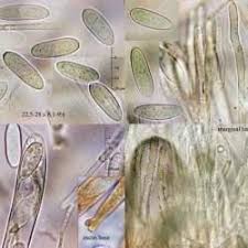 Attēlu rezultāti vaicājumam “Lachnellula willkommii”