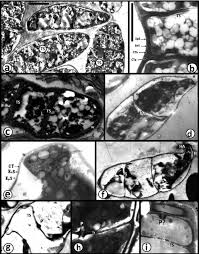 Attēlu rezultāti vaicājumam “Dacrymyces chrysospermus spores”