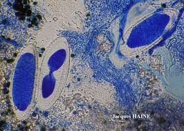 Attēlu rezultāti vaicājumam “Pertusaria pertusa”