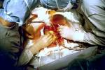 <b>surgery</b> Image 657B-PH.jpg