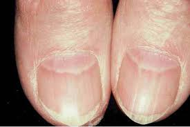 Image result for lunula nail