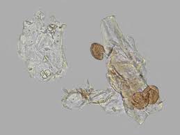 Attēlu rezultāti vaicājumam “Licea testudinacea spores”