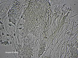 Attēlu rezultāti vaicājumam “Thelopsis rubella”