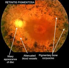 Attēlu rezultāti vaicājumam “Reticularia sp.”