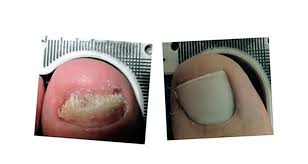 Image result for lunula nail