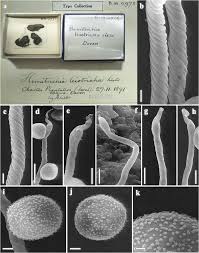 Attēlu rezultāti vaicājumam “Hemitrichia leiotricha spores”