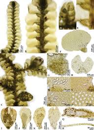 Attēlu rezultāti vaicājumam “Jungermannia hyalina cells”