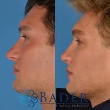 Attēlu rezultāti vaicājumam “Diderma testaceum young”