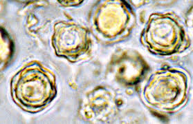 Attēlu rezultāti vaicājumam “Collaria rubens spores”