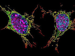 Attēlu rezultāti vaicājumam “Heterotrichia pomiformis (syn. Arcyria pomiformis)”