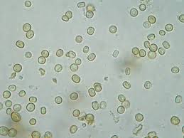 Attēlu rezultāti vaicājumam “Chaenotheca brachypoda”