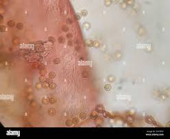 Attēlu rezultāti vaicājumam “Trichia alpina macro”