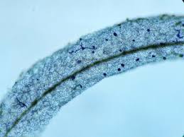 Attēlu rezultāti vaicājumam “Stemonitopsis hyperopta”