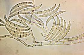 Attēlu rezultāti vaicājumam “Lophozia badensis sporophyte”