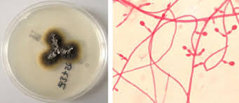 Attēlu rezultāti vaicājumam “Stemonitopsis aequalis var. microspora stalked”