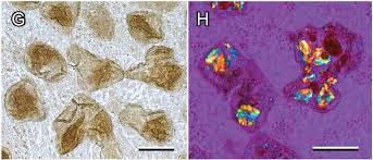 Attēlu rezultāti vaicājumam “Lycogala miserum”