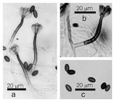 Attēlu rezultāti vaicājumam “Badhamia affinis var. microspora spores”