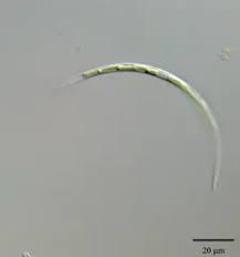 Attēlu rezultāti vaicājumam “Comatricha elegans var. microspora”