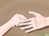 How to Cure Trigger Finger: 10 Steps (with Pictures) - wikiHow