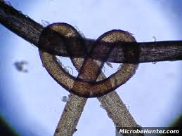 Image result for human hair microscope image