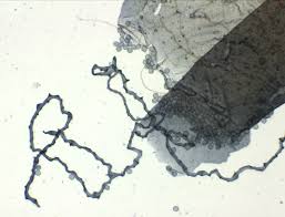 Attēlu rezultāti vaicājumam “Arcyria affinis stalked”