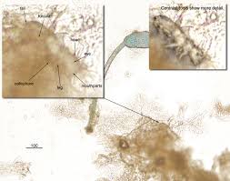 Attēlu rezultāti vaicājumam “Collembola”