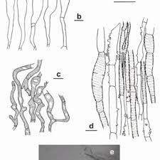 Attēlu rezultāti vaicājumam “Lamproderma gulielmae spores”