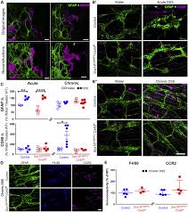 Attēlu rezultāti vaicājumam “Enteridium variabile macro”
