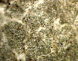 Attēlu rezultāti vaicājumam “Nostoc pruniforme”