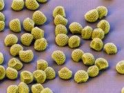 Attēlu rezultāti vaicājumam “Lignydium muscorum spores”