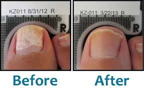 Image result for lunula nail