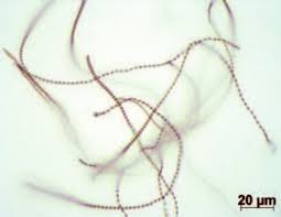 Attēlu rezultāti vaicājumam “Physarum alexandrowiczii”