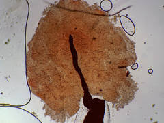 Attēlu rezultāti vaicājumam “Diachea leucopodia young”