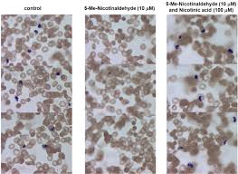 Attēlu rezultāti vaicājumam “Badhamia lilacina plasmodium”